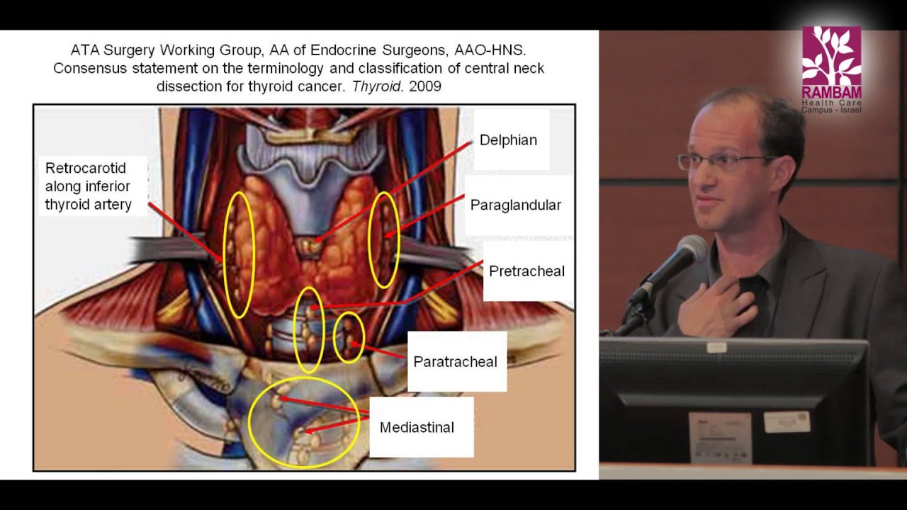 Surgical Treatment for Papillary Thyroid Cancer | Contra Central Neck Dissection