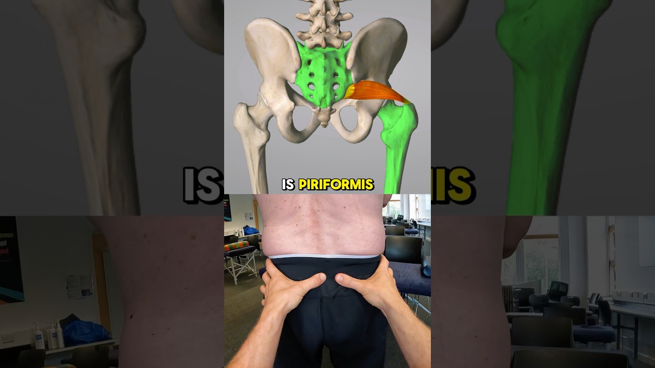 How to find Piriformis