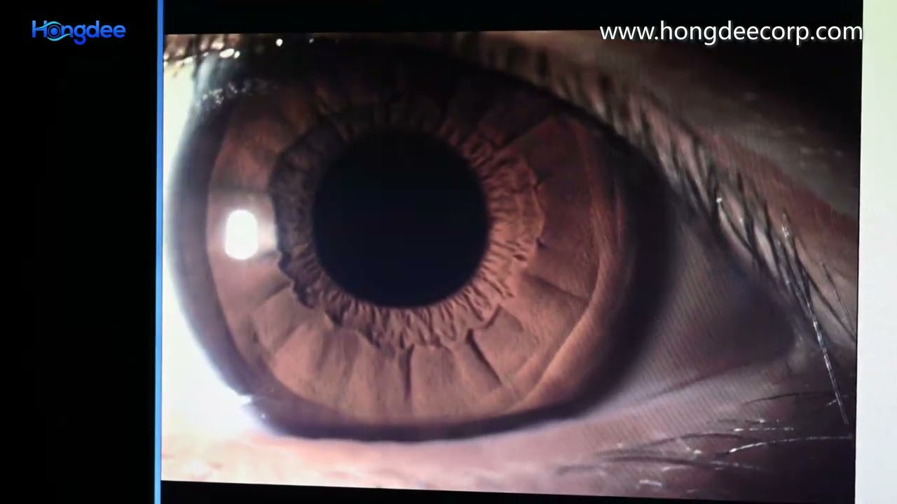 How do you use a CCD LED slit lamp on a computer?