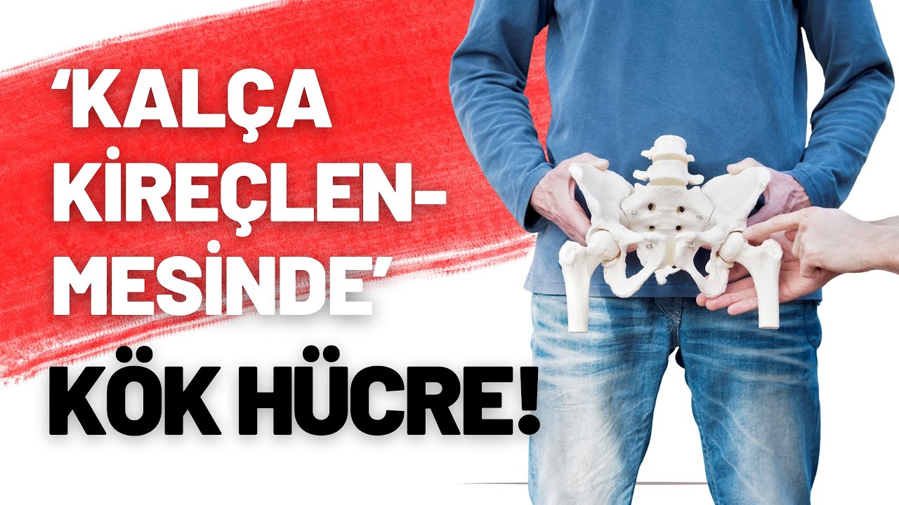 DOÇ.DR.AHMET İNANIR / KALÇA KİREÇLENMESİNDE KÖK HÜCRE TEDAVİSİ !