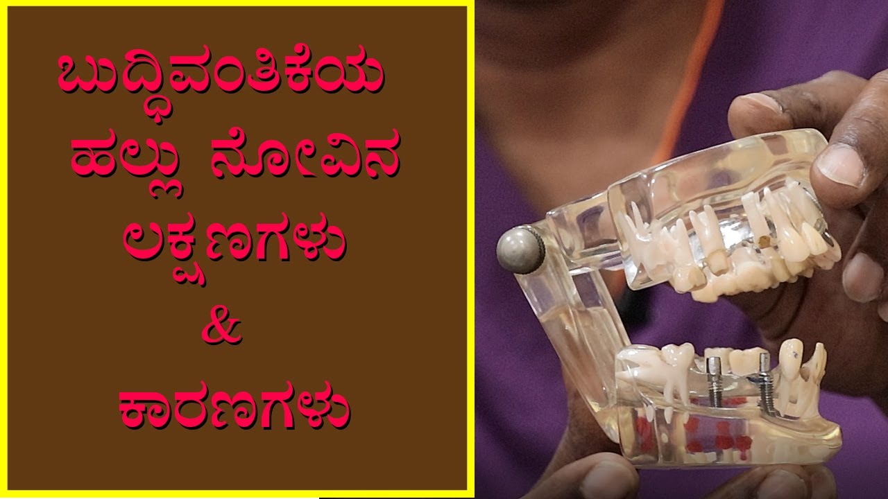 Wisdom Teeth Pain: Symptoms & Causes | Vijay Karnataka