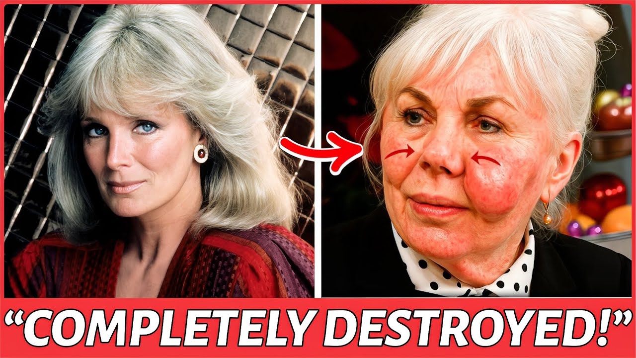 16 Golden Age Stars Who RUINED Their Faces with Plastic Surgery | Vintage Hollywood