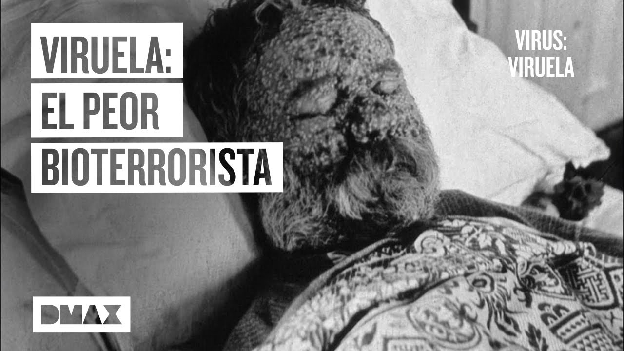 Virus de la viruela: la enfermedad m&aacute;s letal podr&iacute;a volver