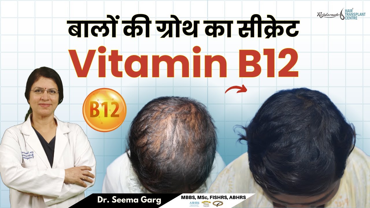 आपके बालों में ये परिवर्तन Vitamin B12 की कमी के लक्षण जानें | बालों की ग्रोथ का सीक्रेट Vitamin B12