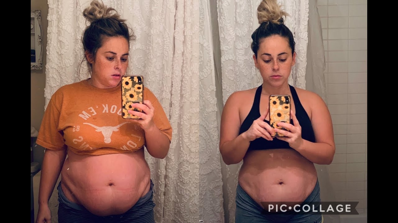 I lost 20 pounds in 30 days doing OMAD! 2020 (Intermittent fasting) POSTPARTUM CSECTION