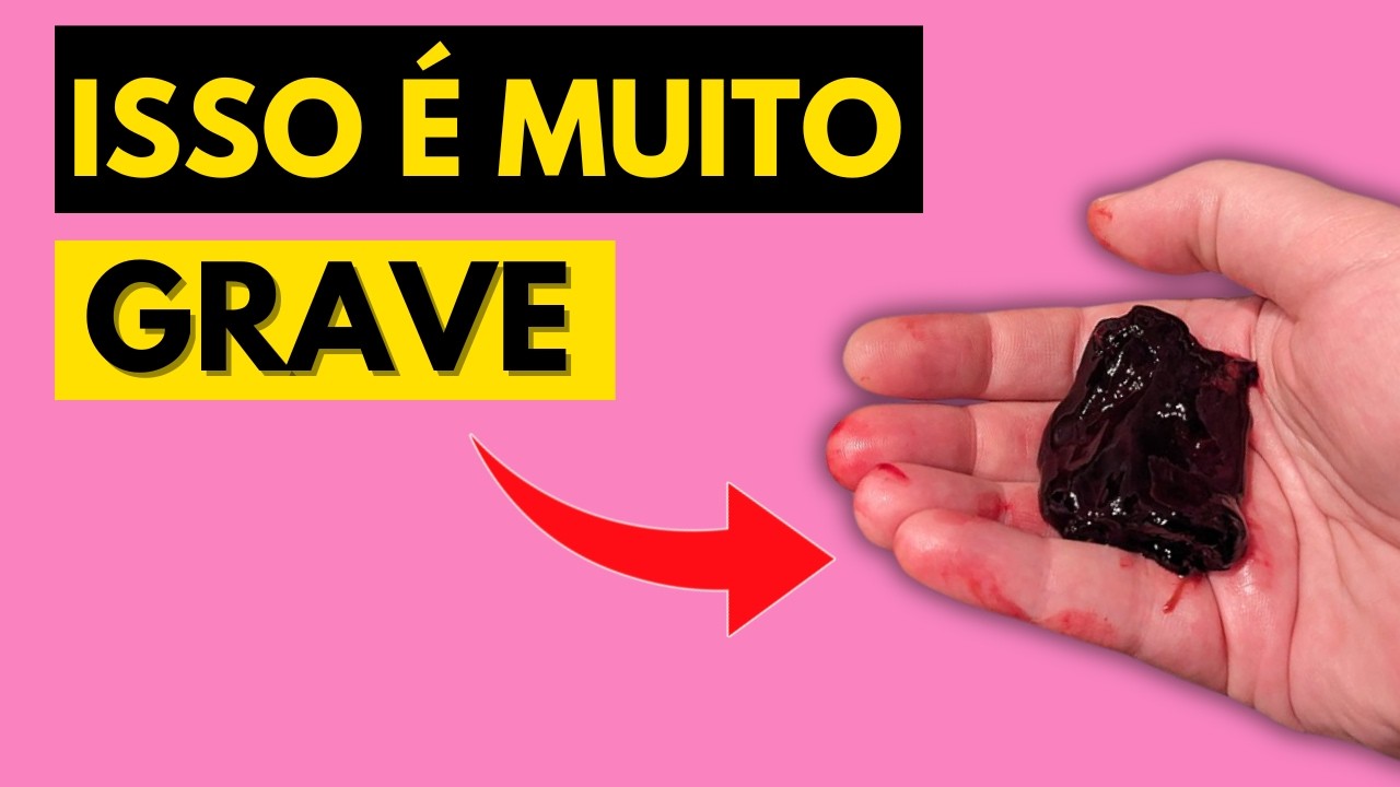8 DOENÇAS PERIGOSAS QUE CAUSAM MENSTRUAÇÃO FORTE E PEDAÇOS DE SANGUE