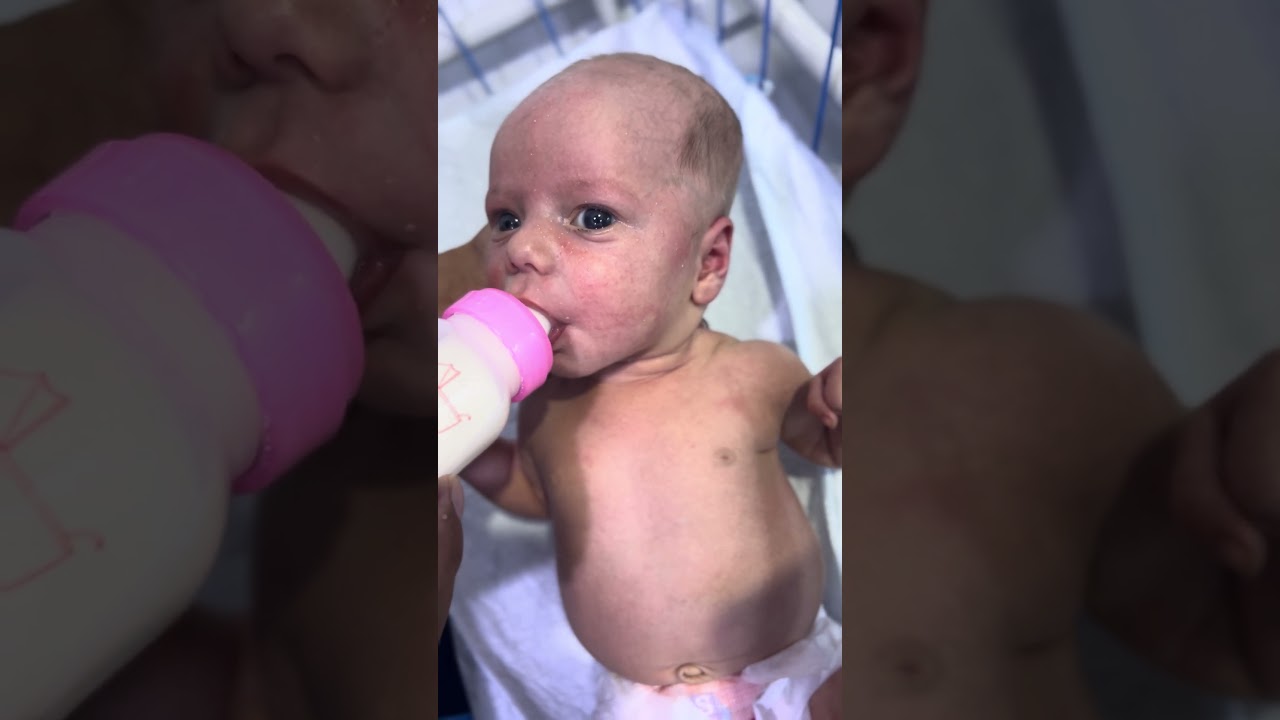 Baby Oral Feeding Trial in NICU | Lovely Recovery Moment 💖