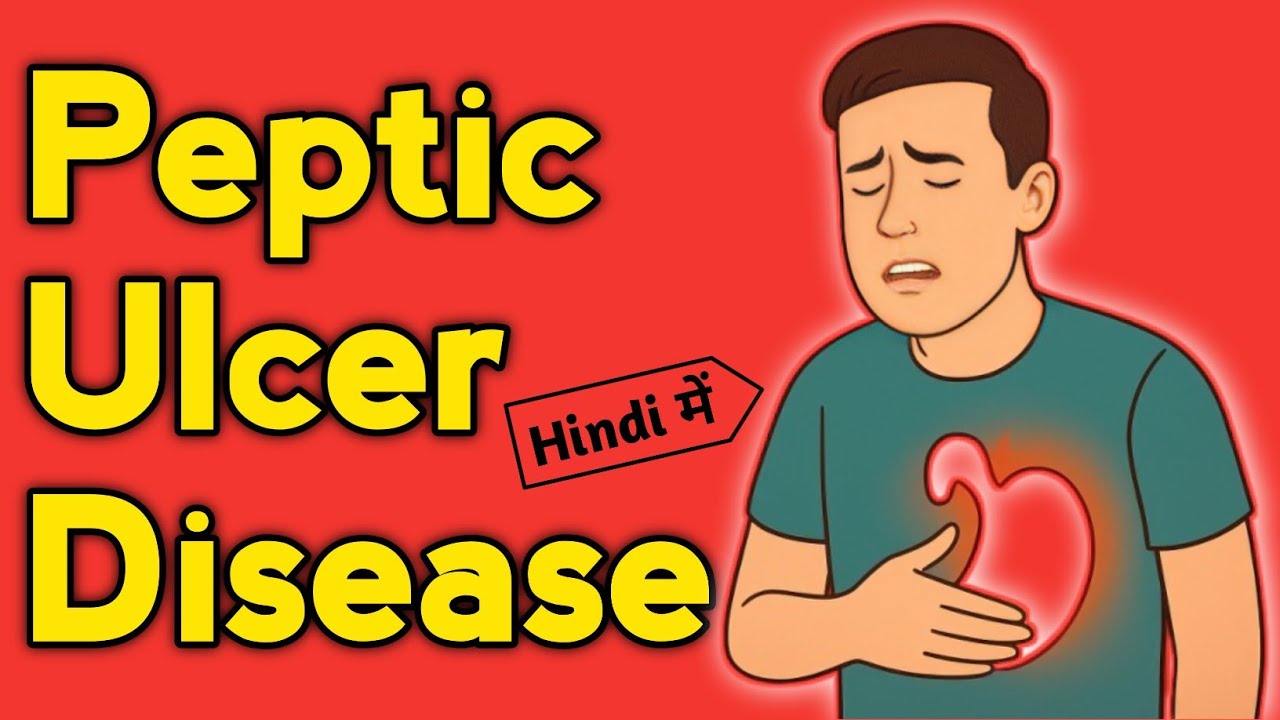 Peptic Ulcer Disease | Pharmacotherapeutics | Gastrointestinal Disorders | Chapter 6 Part 2