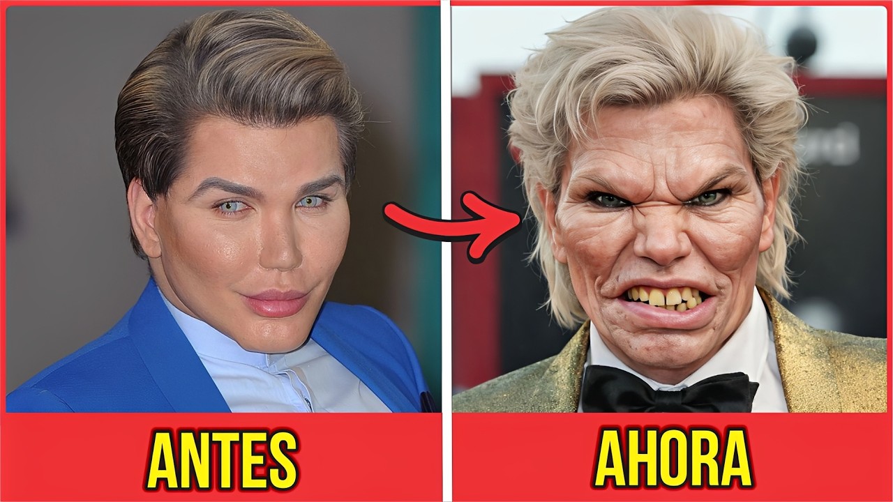 21 Estrellas de Hollywood que Arruinaron su Rostro con Cirugías Plásticas