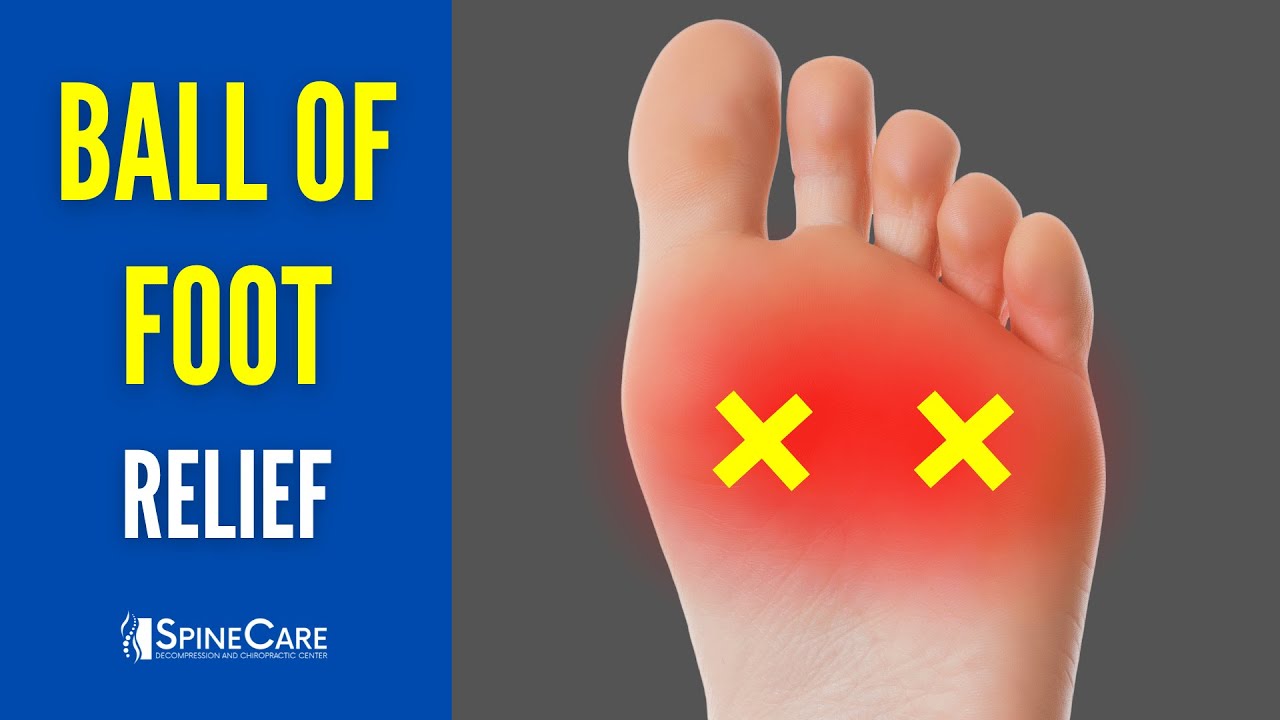 How to Relieve Ball of Foot Pain IN SECONDS