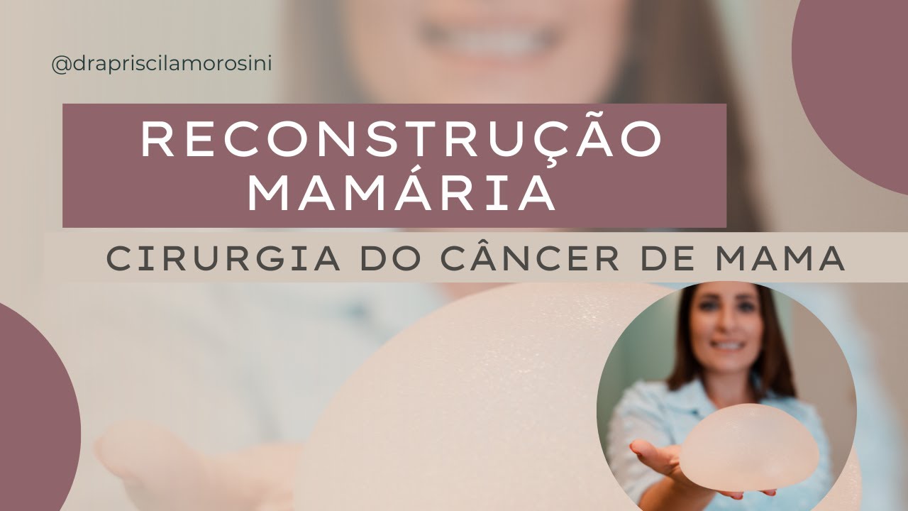 RECONSTRUÇÃO MAMÁRIA NO CÂNCER DE MAMA: expansor ou prótese?