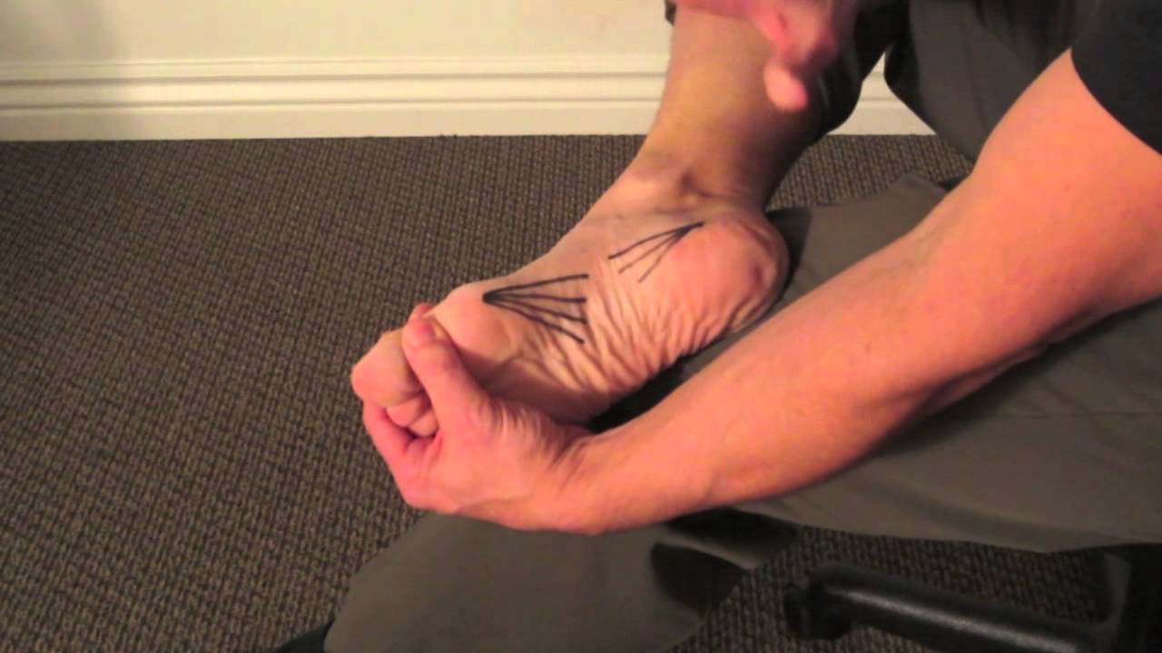Arch Pain PRT Self-Release Treatment.mov
