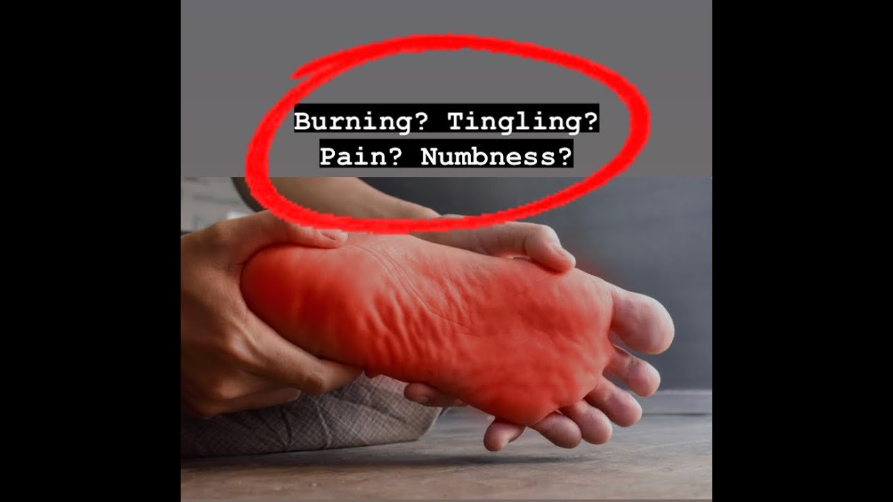 Chiropractor Pittsburgh PA | 95% success rate | Peripheral Neuropathy Relief in Pittsburgh, PA
