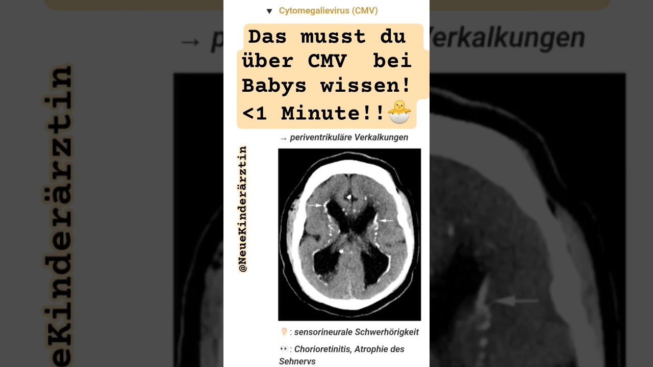 CMV BASICS f&uuml;r Klinik & Praxis! #medicine #medizin #knowledge #pediatrics #p&auml;diatrie #medstudents