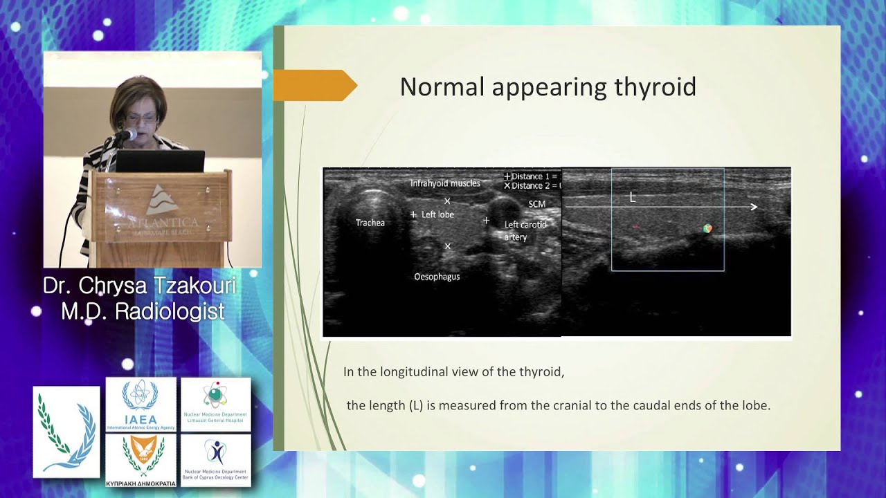 Monday, Ultrasound of Thyroid and Parathyroid glands, Chrysa Tzakouri