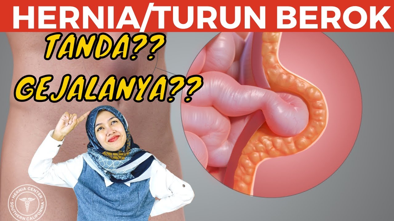 TANDA GEJALA TERKENA PENYAKIT HERNIA/TURUN BEROK