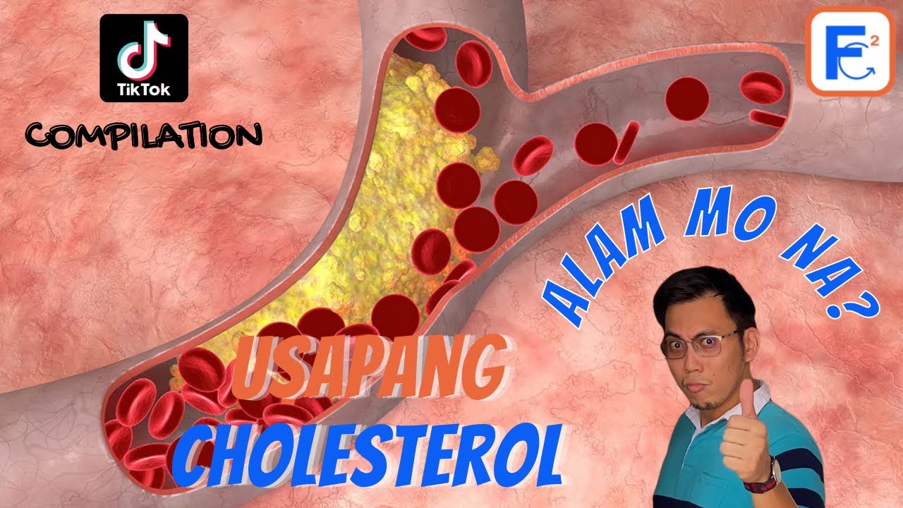 Umiinom ka ba ng GAMOT para sa CHOLESTEROL mo? I DOK CIS