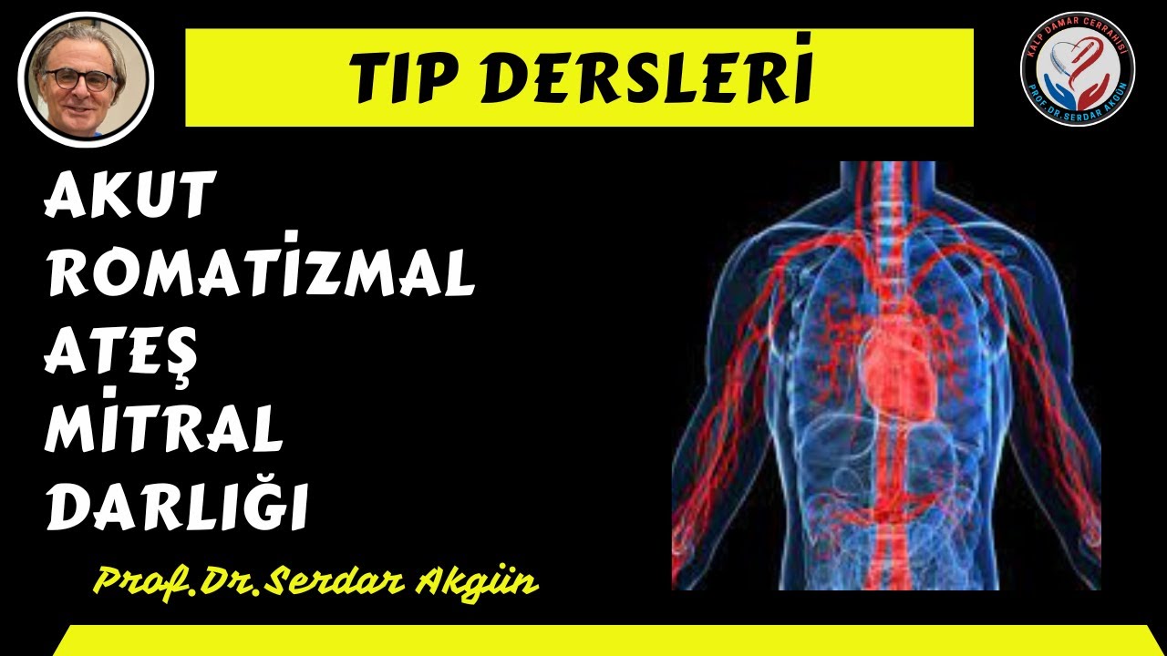 AKUT ROMATİZMAL ATEŞ, MİTRAL DARLIĞI