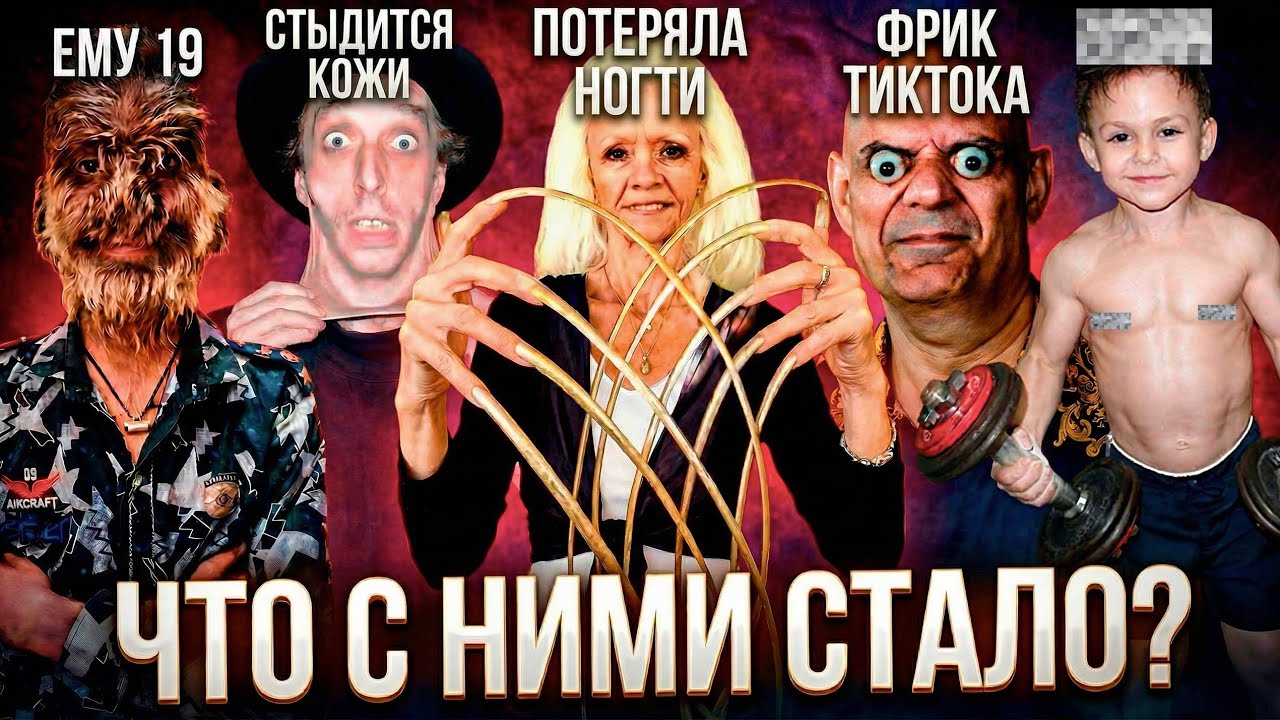 ЧТО СТАЛО С ЛЮДЬМИ ИЗ КНИГИ РЕКОРДОВ ГИННЕССА? Они стыдятся себя? 