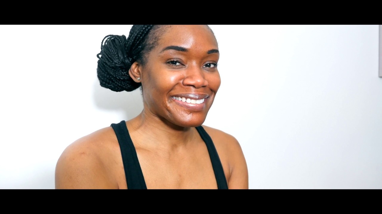 Why I love my scar: A badge of honor