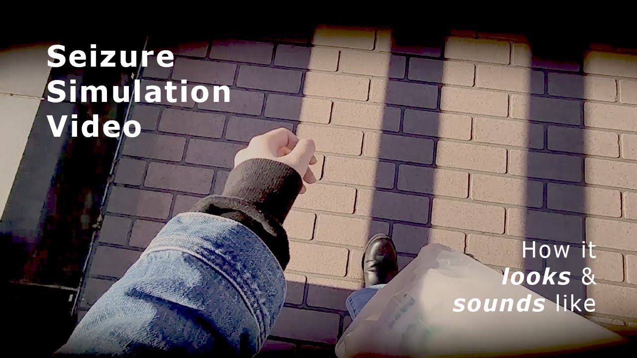 Epilepsy Seizure Simulation Video (Aura/Focal/Partial)