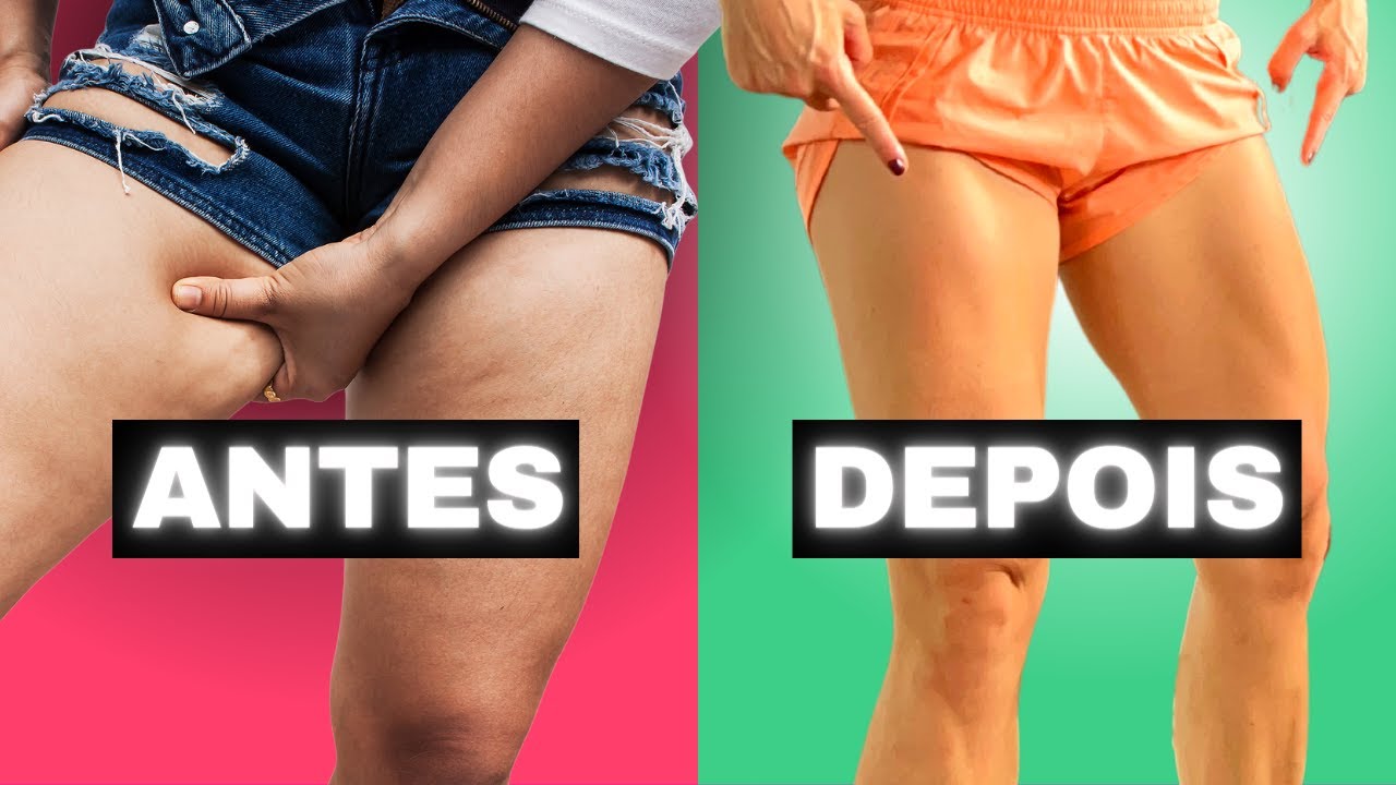 O QUE É MELHOR PARA FLACIDEZ DE PERNAS? | COXAS DEFINIDAS