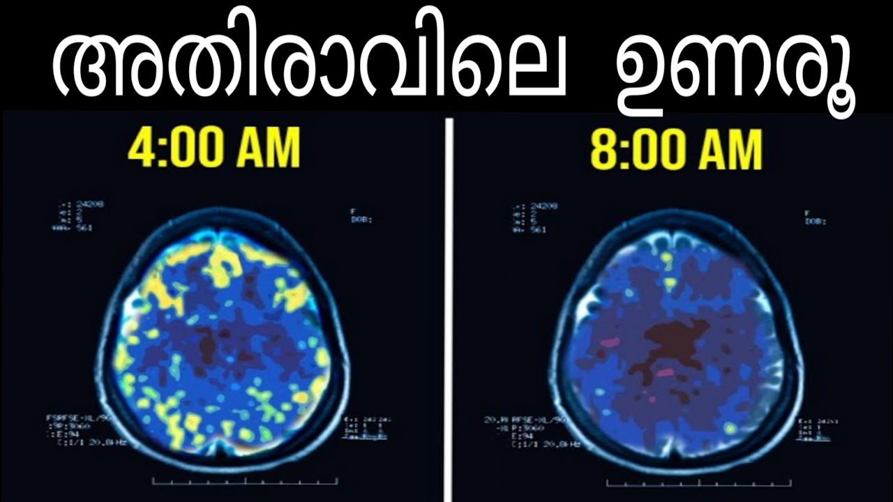 EARLY MORNING ഉണരുന്നതിനുള്ള ഒരൊറ്റ രഹസ്യം || How to Wake Up at Early  || MALAYALAM || smarter u