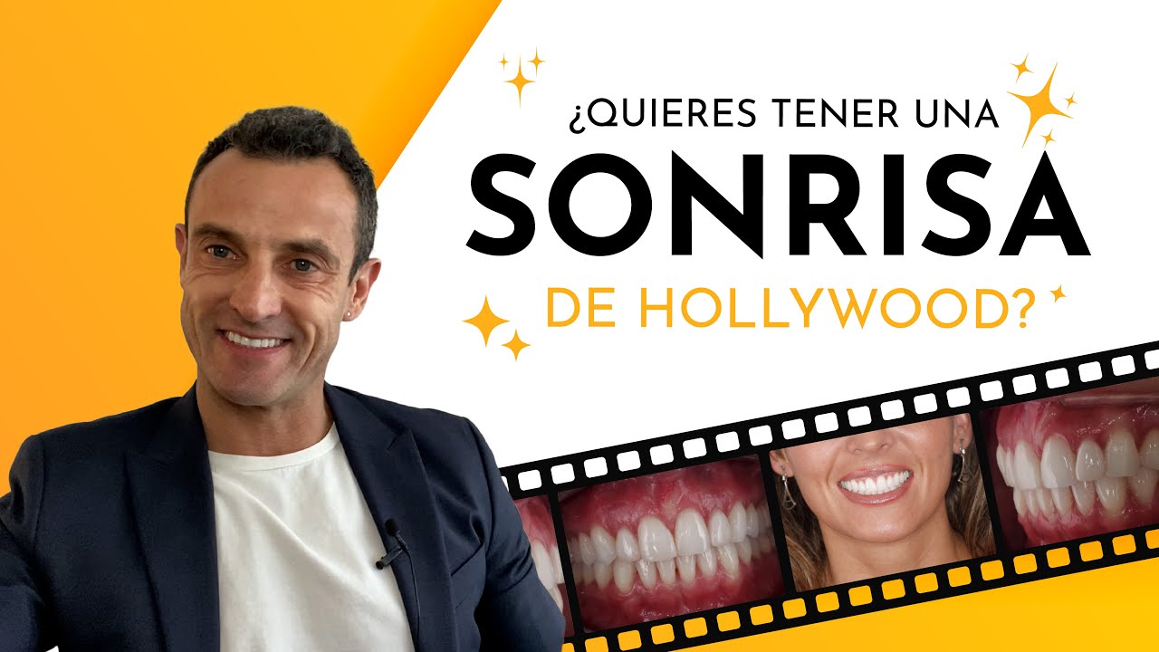 Descubre cómo tener la sonrisa perfecta: Consejos y secretos