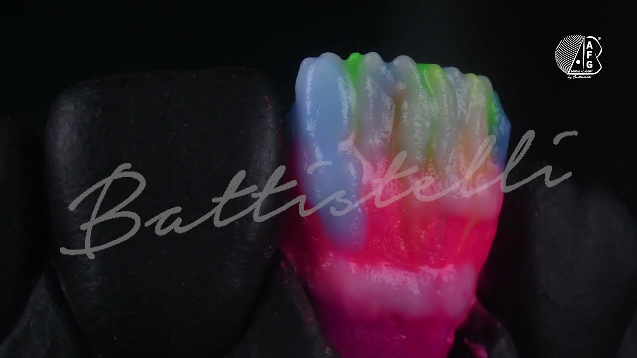 Alberto Battistelli: AFG 3D Dental Painting