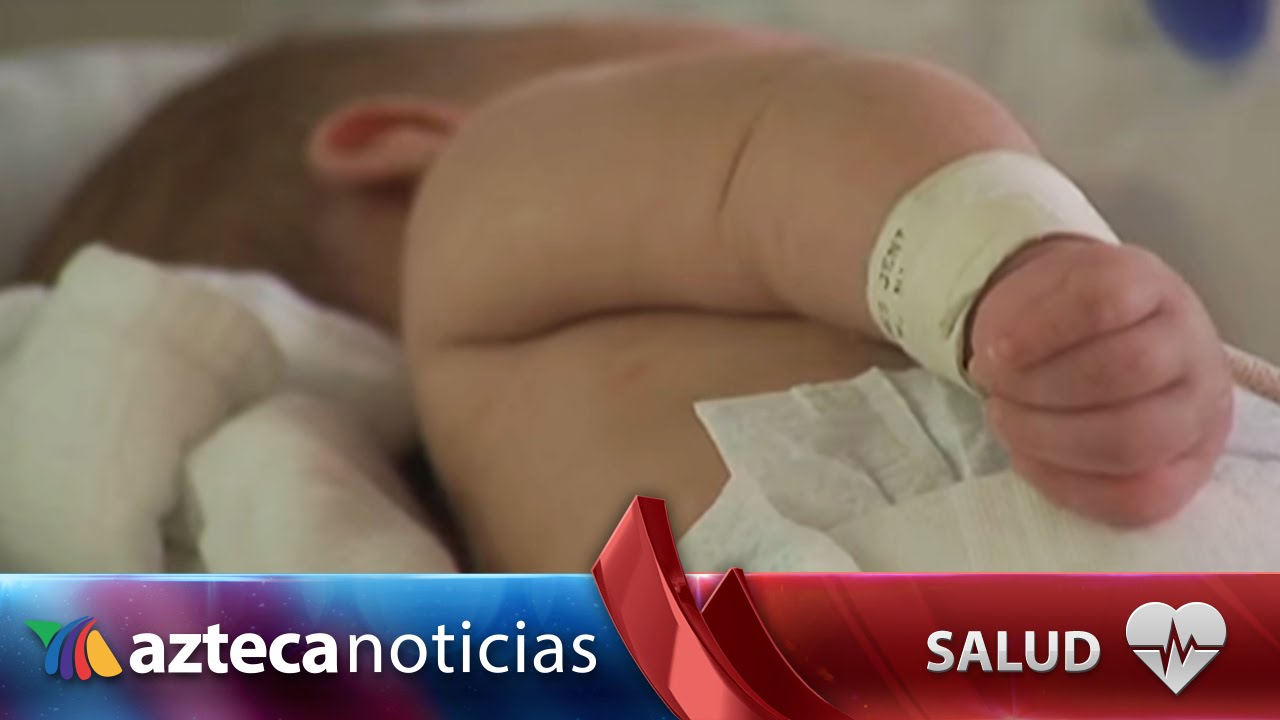 Atienden a niños con problemas cardíacos con catéteres