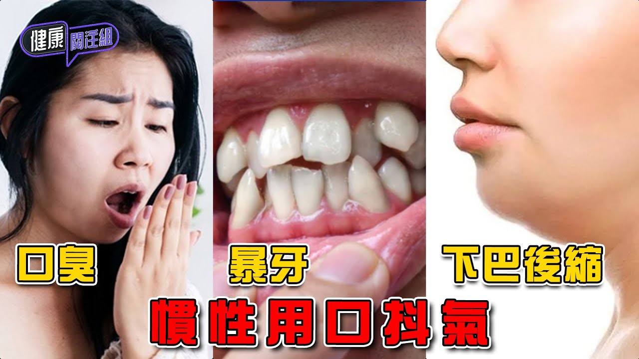 慣性用口抖氣 口臭 暴牙 下巴後縮 ｜ 健康關注組 ｜ EP501 ｜ 用口抖氣 ｜ 鼻塞 ｜ 鼻敏感 ｜ 鼻炎 ｜ 鼻瘜肉 ｜ 吳雲甫 ｜ 麥詩敏 ｜ HOY TV 77台