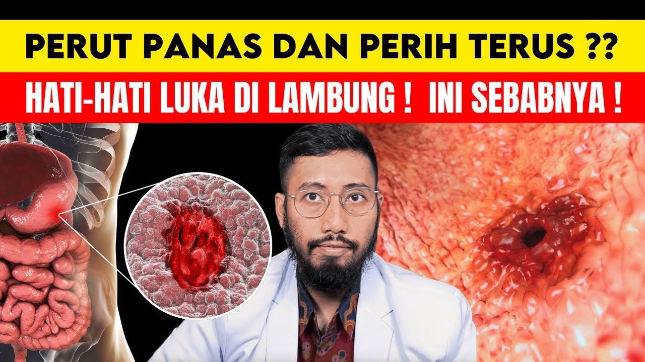 Luka Lambung & Tukak Lambung: Kenali Penyebab, Gejala, & Pengobatan