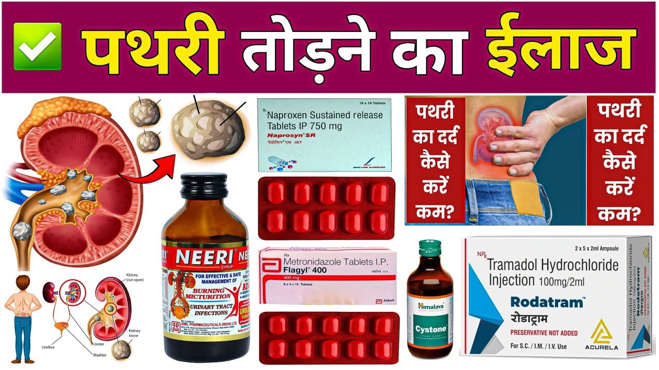 पथरी का ईलाज 😱 | Kidney Stone Treatment In Hindi | Nephrolithiasis Treatment | दवाईयों | Pharmacy