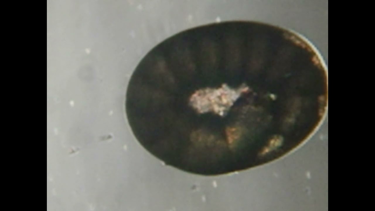 flea egg（ノミの卵）