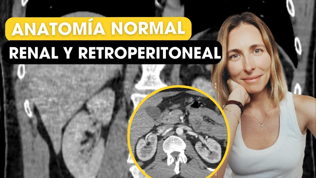 Anatomía renal y retroperitoneal por TC 🔥
