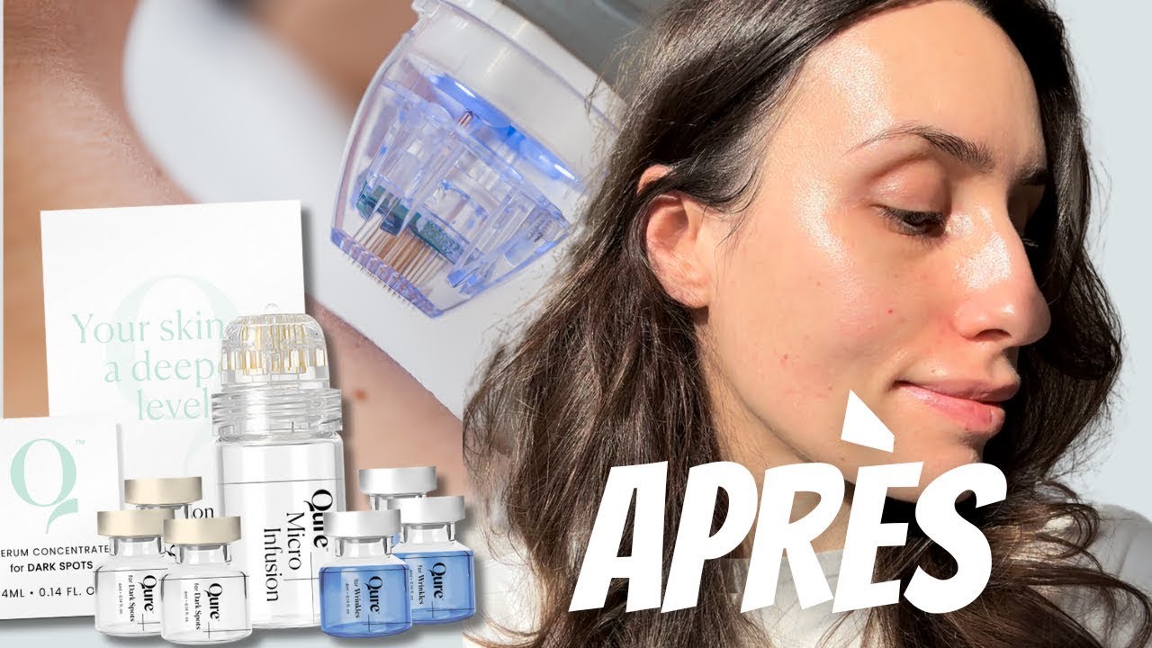 Micro infusion : Mon avis sur Qure après plusieurs mois de test