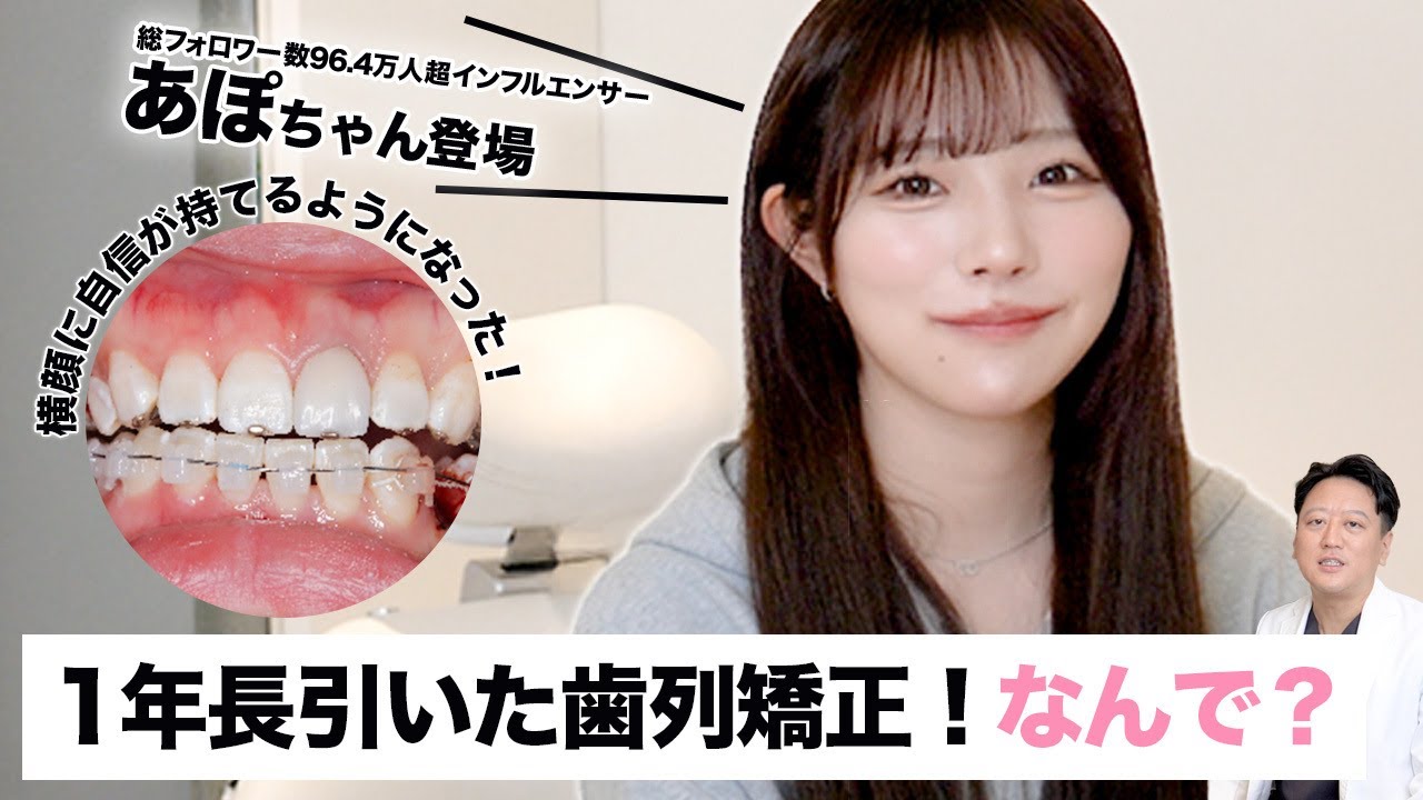 【24歳女性】カリスマインフルエンサーPKAのあぽちゃん登場！矯正治療が1年長引いた症例や矯正の悩みをお話ししてくれました【審美歯科 歯列矯正 歯並び 歯ぎしり】