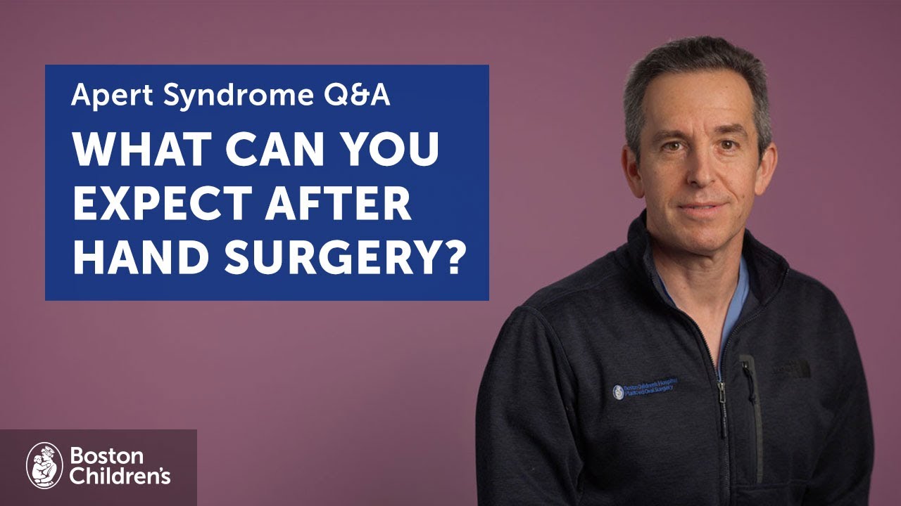 What can Apert syndrome patients expect after hand surgery? | Boston Children's Hospital
