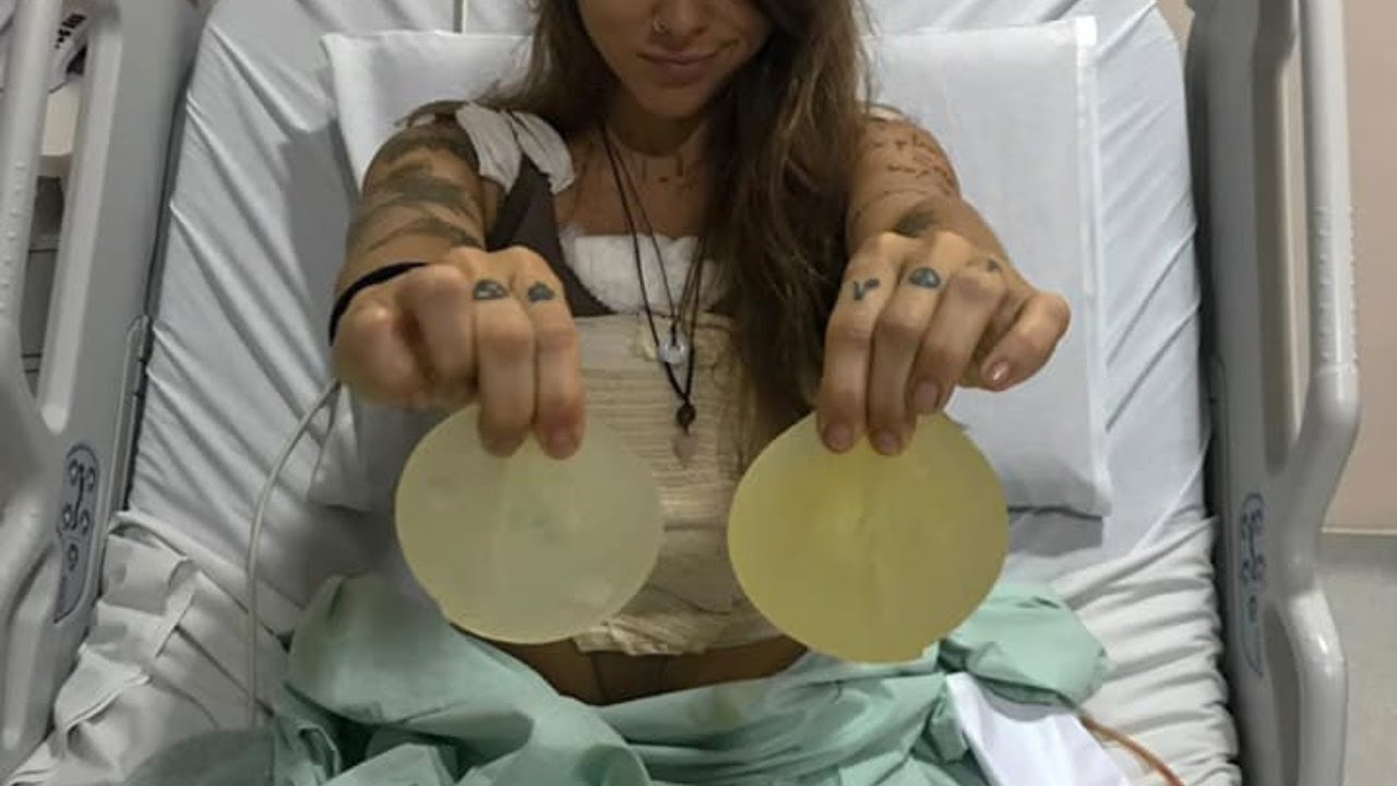 EXPLANTE DE SILICONE. Live: Porque eu tirei o meu silicone!