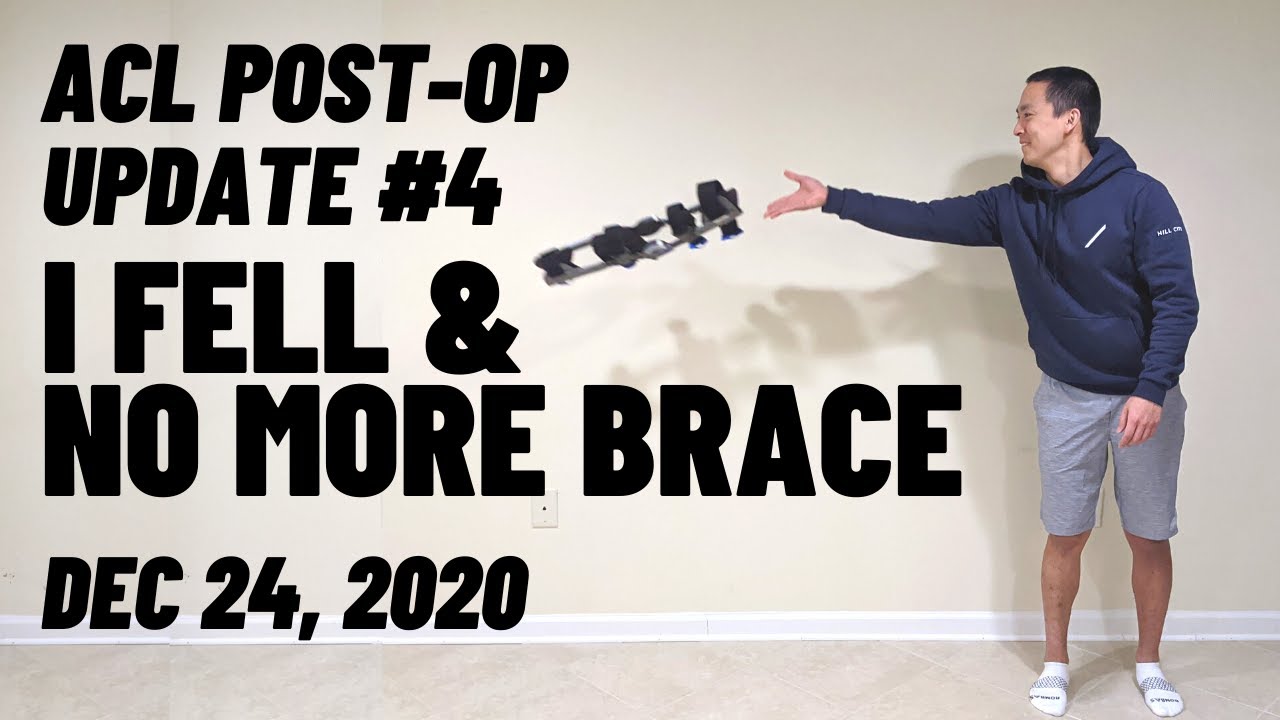 ACL Post Surgery Update #4 - I FELL & NO MORE BRACE!