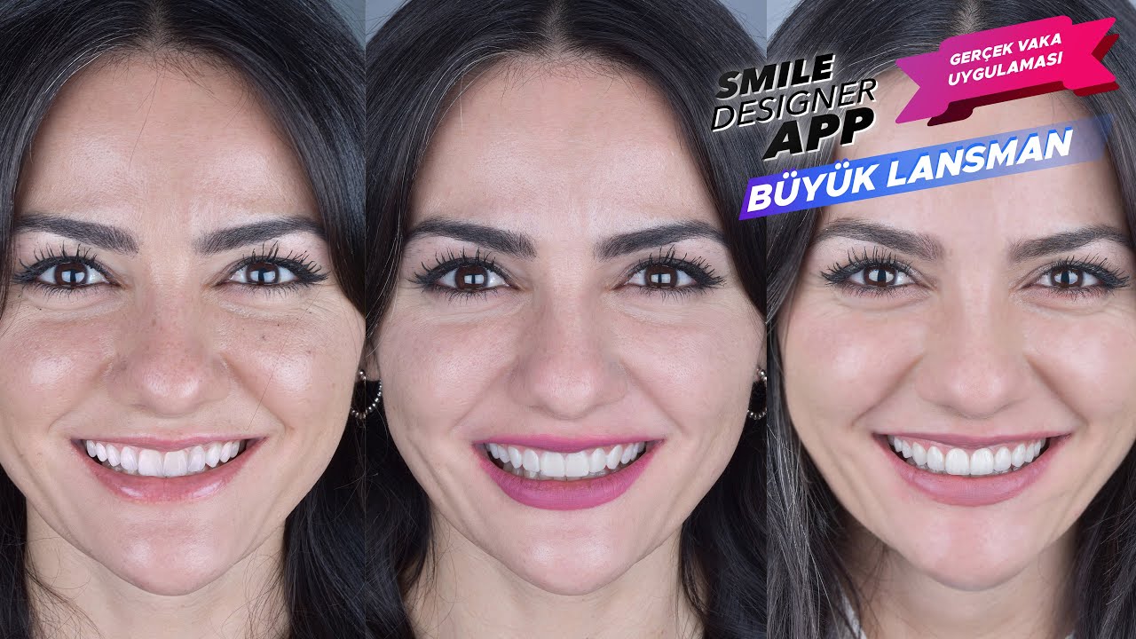 Smile Designer App | Büyük Lansman (2 Ocak 2021 - 19:00)