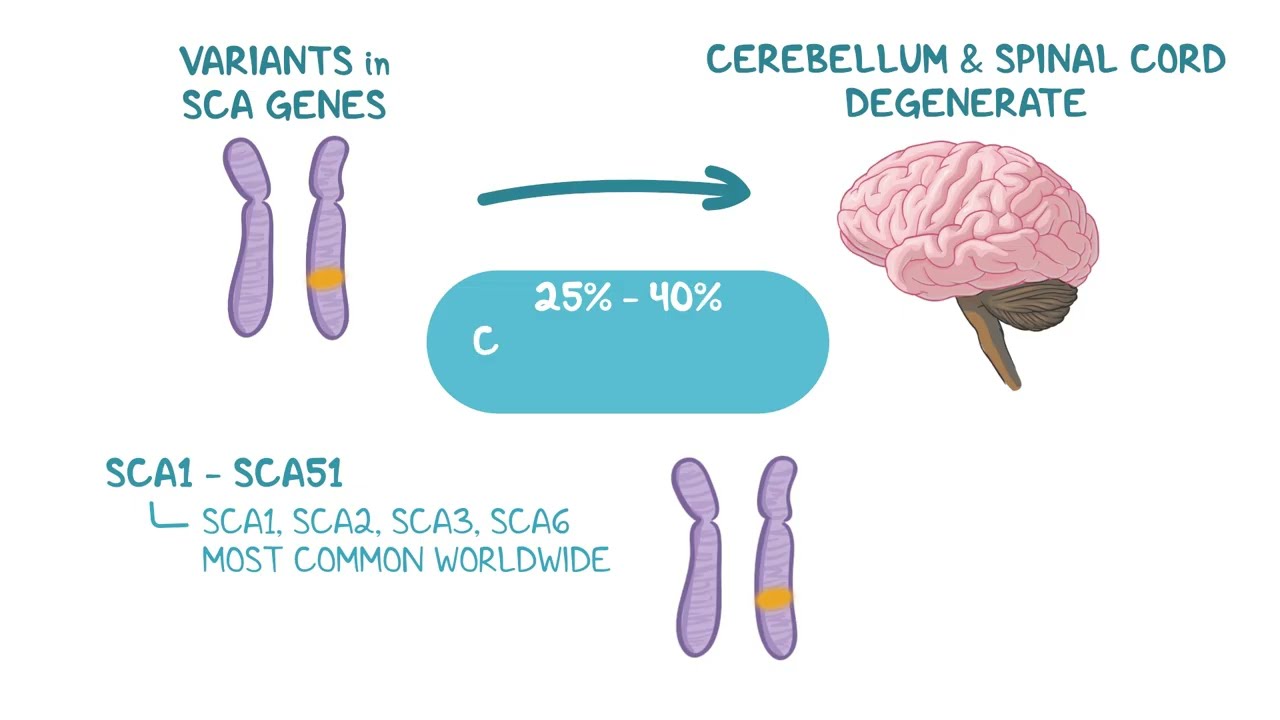 Spinocerebellar Ataxia: Symptoms, Types & Genetic Inheritance