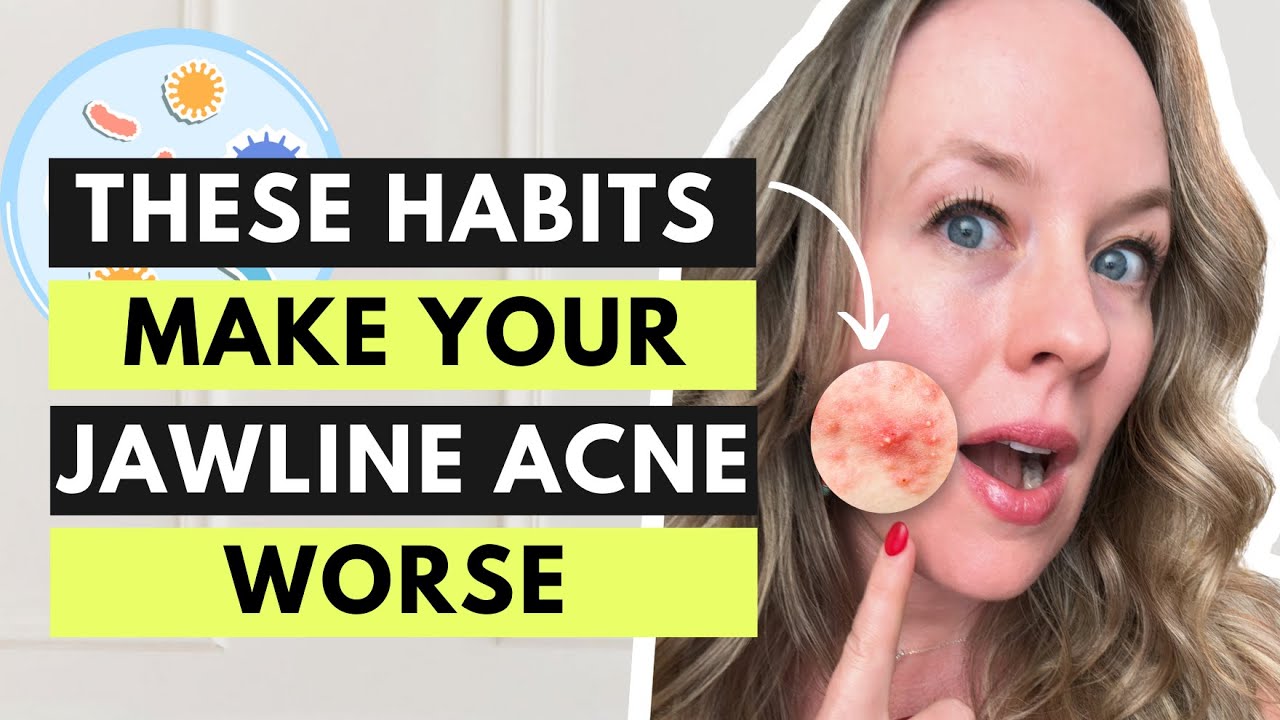 Jawline Acne Causes - 5 Morning Habits That Are Making Your Acne Worse (And What to Do Instead!)