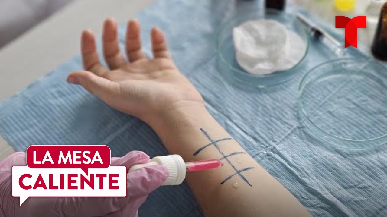 Nuevo estudio explica las posibles causas del origen de las alergias en niños | La Mesa Caliente