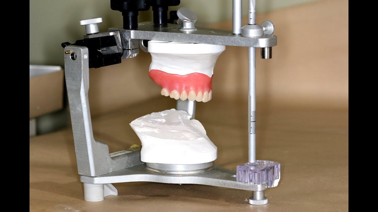 Clinical Remount of Complete Dentures