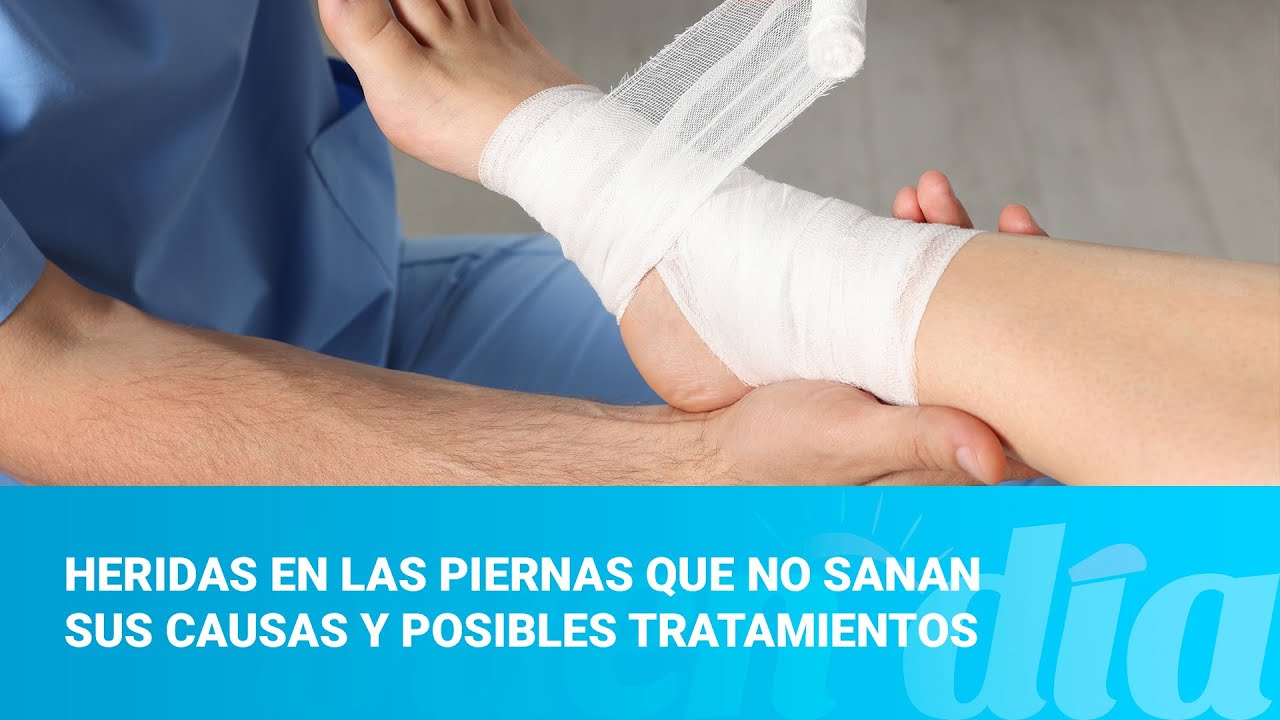 Heridas en las piernas que no sanan sus causas y posibles tratamientos