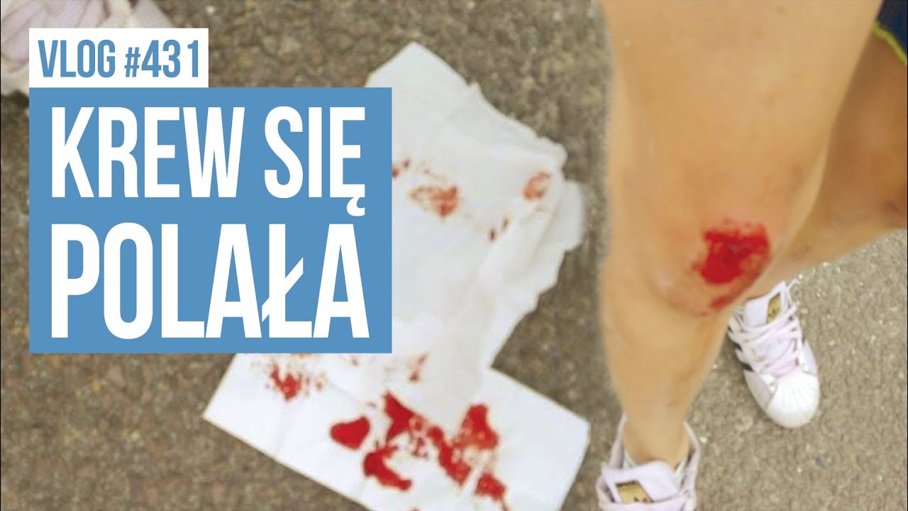 Krew się polała / VLOG #431