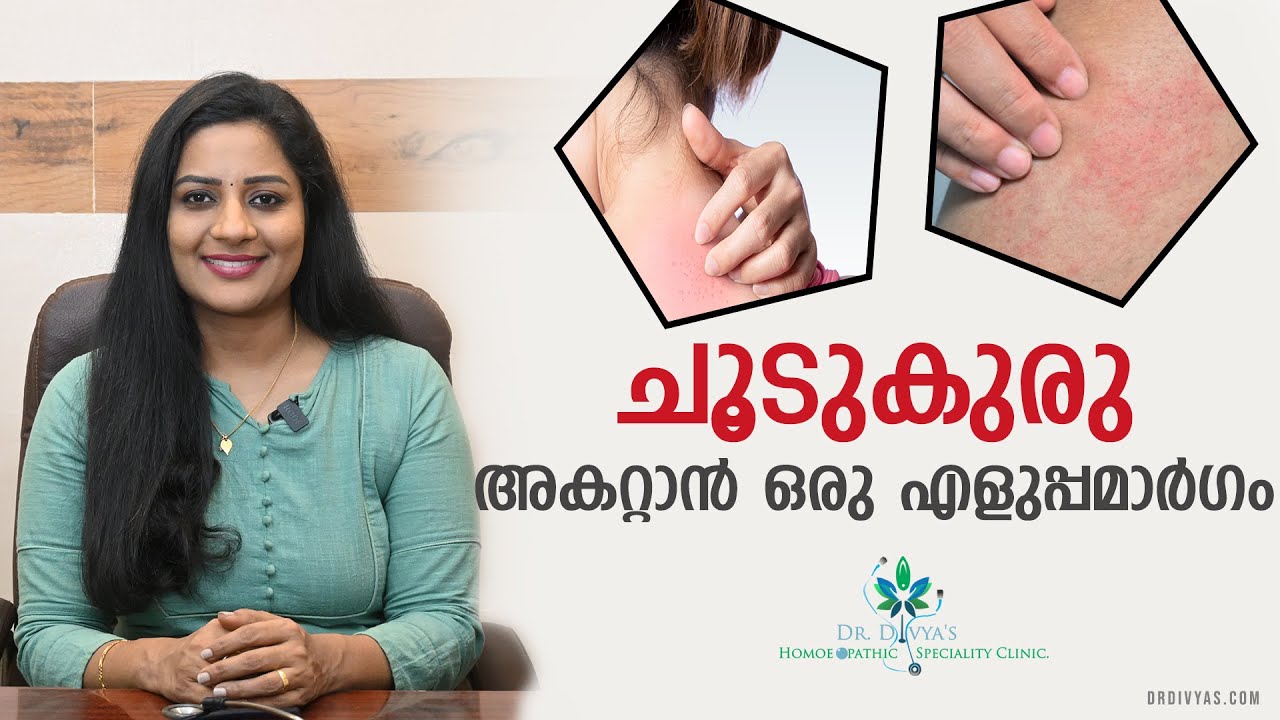 ചൂടുകുരു അകറ്റാൻ ഒരു എളുപ്പമാർഗം| How To Treat & Prevent Heat Rash | Summer Skin Rashes Home Remedy