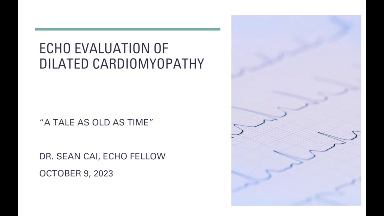 Echocardiographic assessments in dilated cardiomyopathy (DCM)