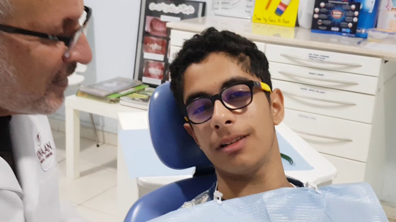 العمر الافضل لتقويم الاسنان (    سنة 12- 14 ) . Optimum Age for ortho trat